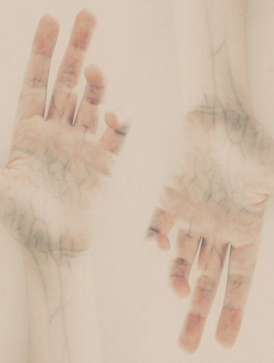 2 hands showing artery and veins in the hands